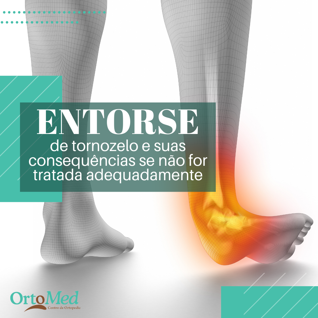 Entorse de tornozelo pode ter mais graves consequências