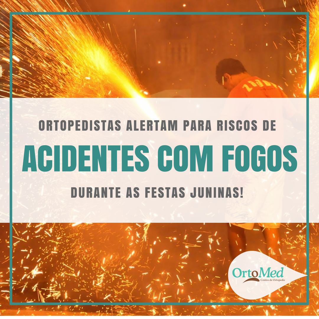 Ortopedistas alertam para risco de acidentes com fogos durante as festas juninas