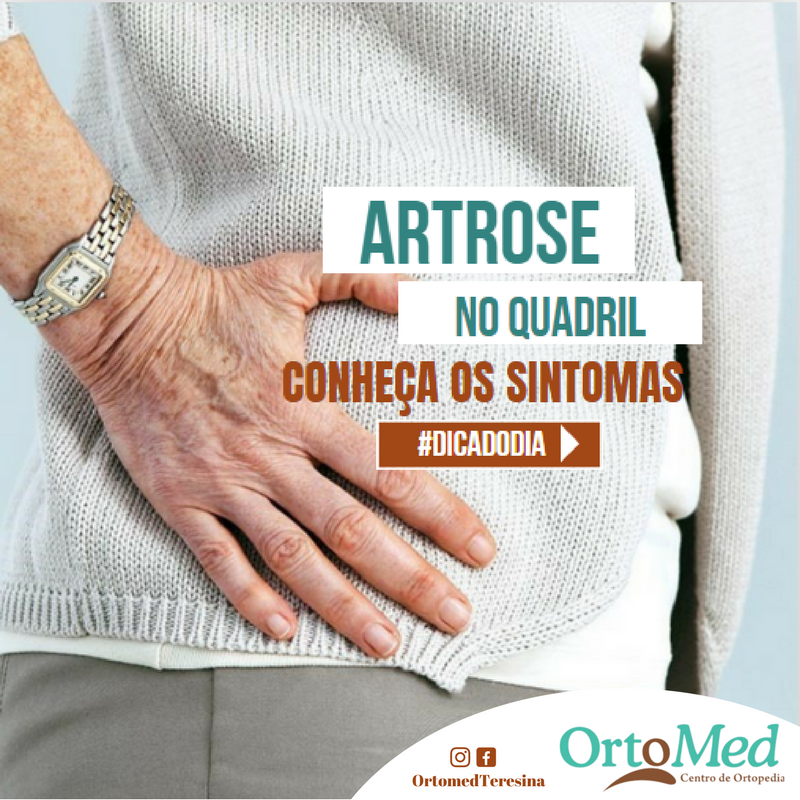 Sentir dores ao andar é um desses sintomas